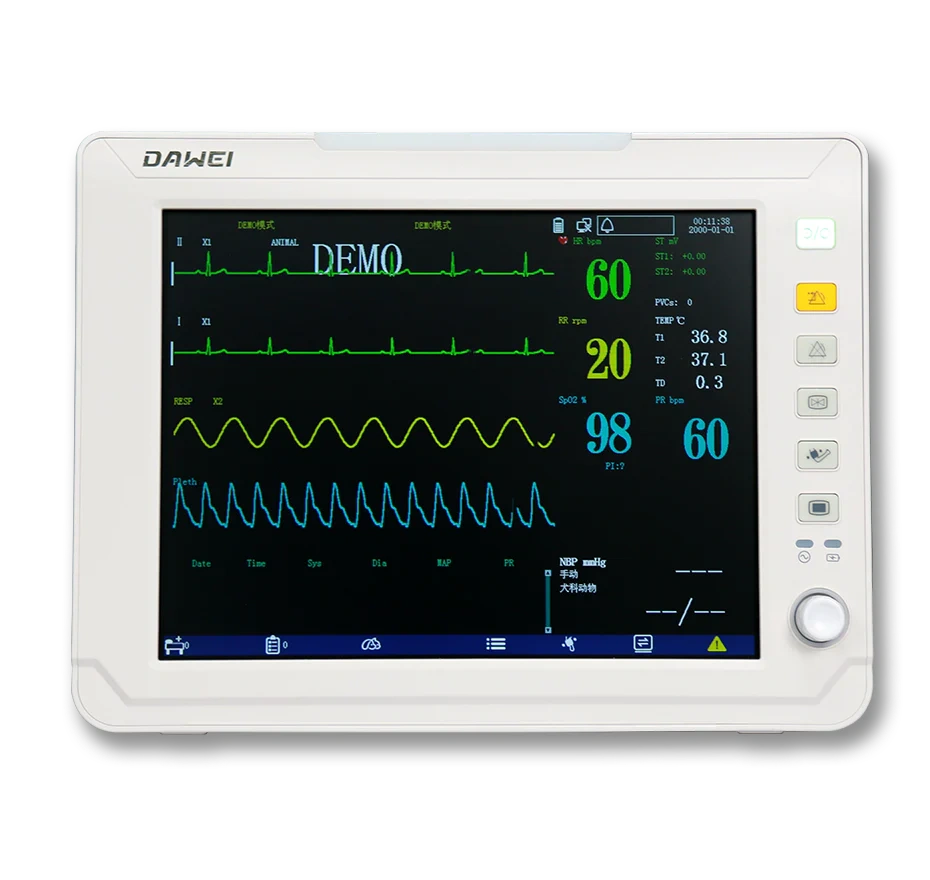 Patient monitors (basic parameters)